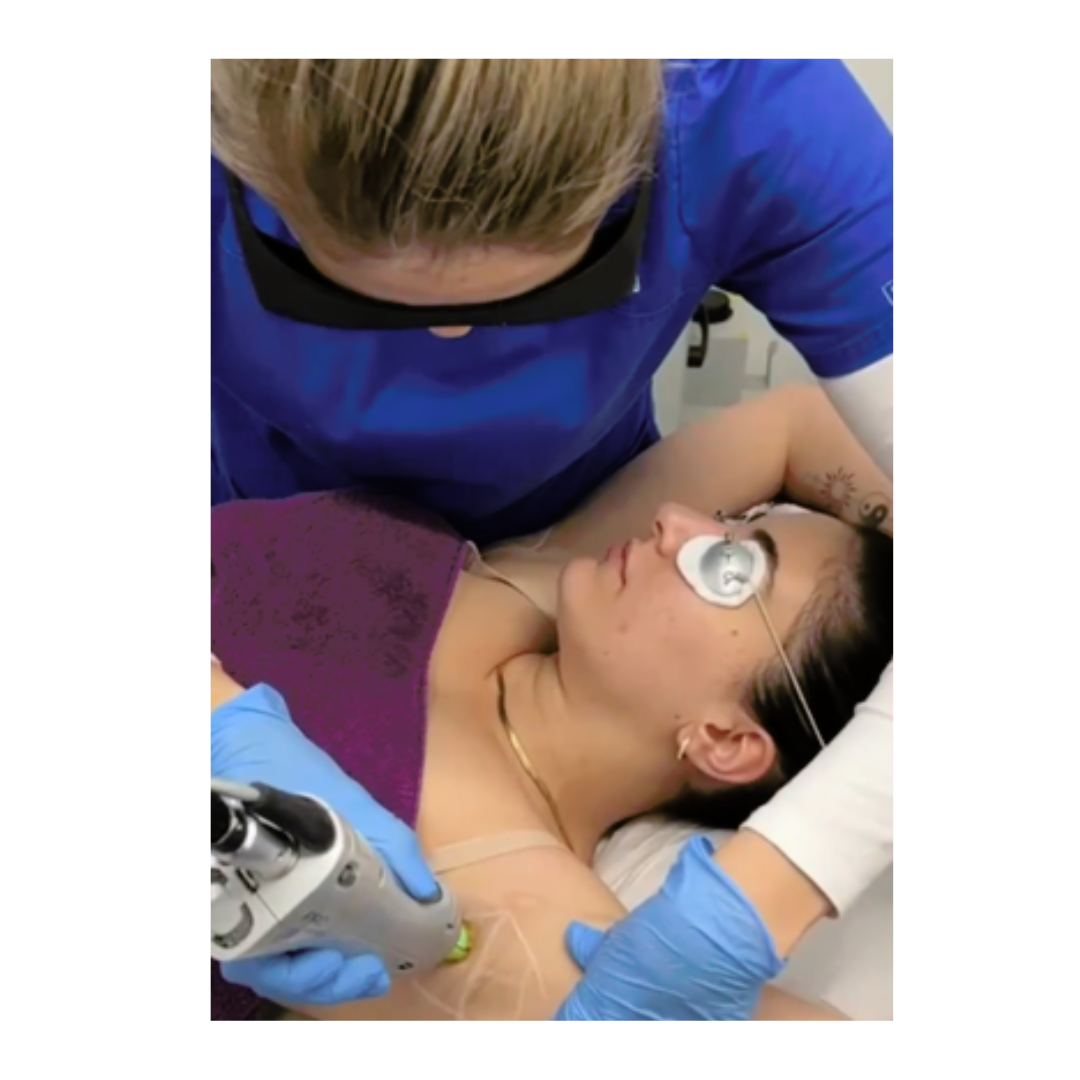 Level 4 Laser Hair Removal