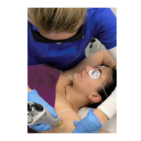 Level 4 Laser Hair Removal