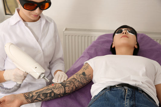 A6 – Level 5 Tattoo Removal