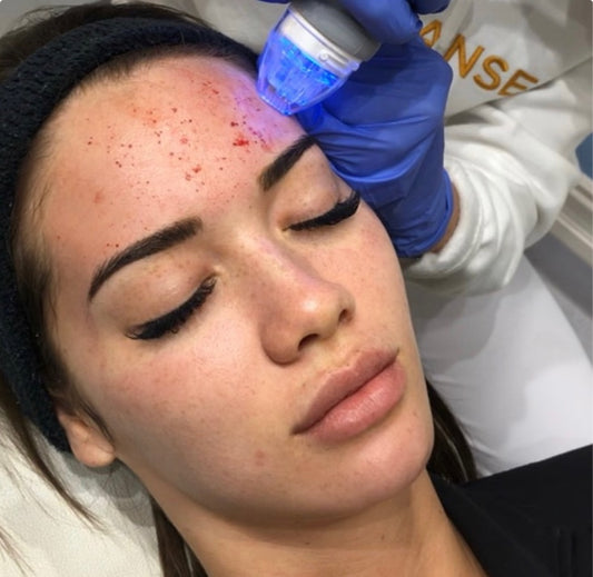 PRP (Hair & Face) Course